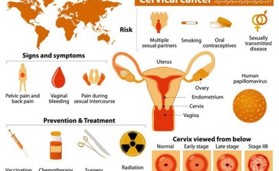 Cervical Cancer: A Forgotten Tragedy